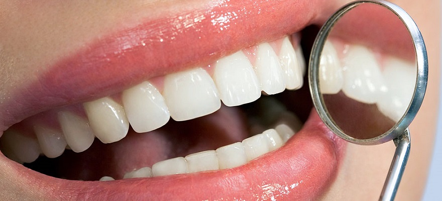 come fare la pulizia dei denti 2